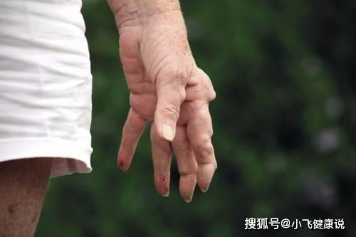 口腔潰瘍反復發作,或許是這6種疾病的預示,別忽視